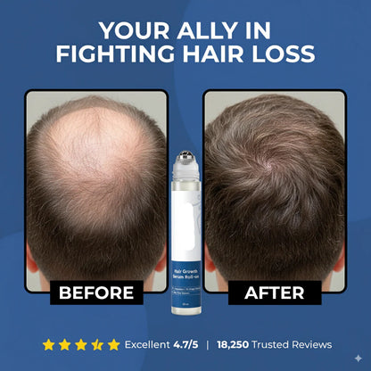 Volmaro hair growth roll on serum