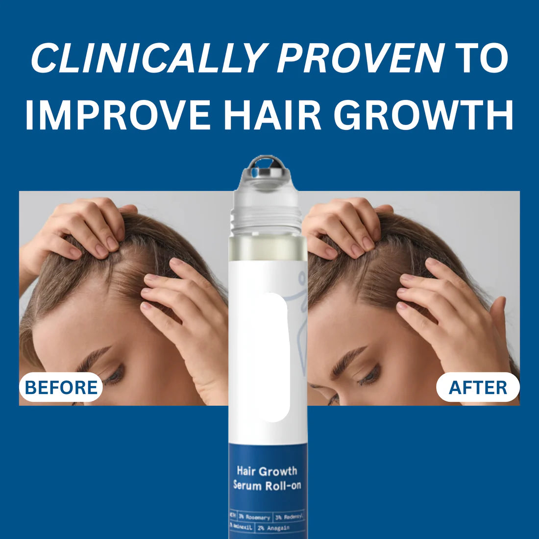 Volmaro hair growth roll on serum