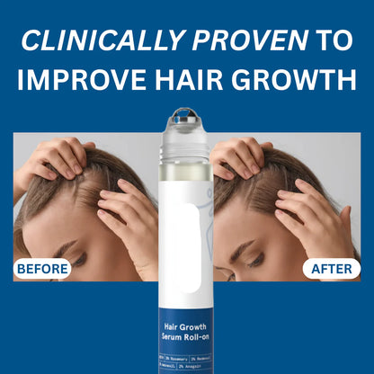 Volmaro hair growth roll on serum