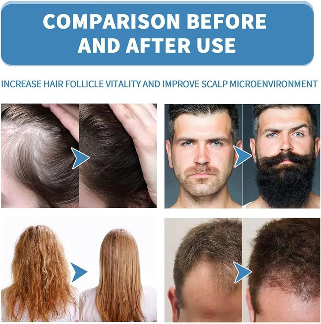 Volmaro hair growth roll on serum
