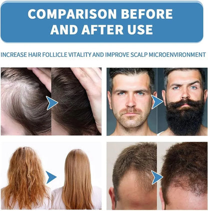 Volmaro hair growth roll on serum